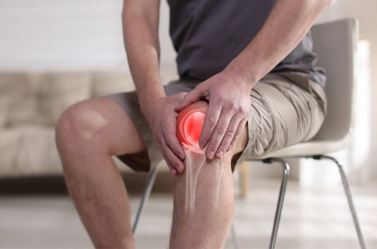 Arthritis image