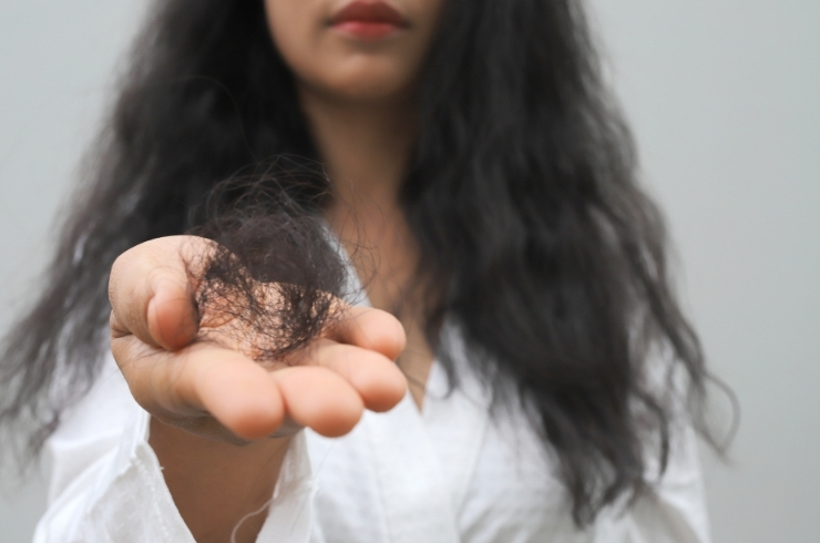 Hair Fall image