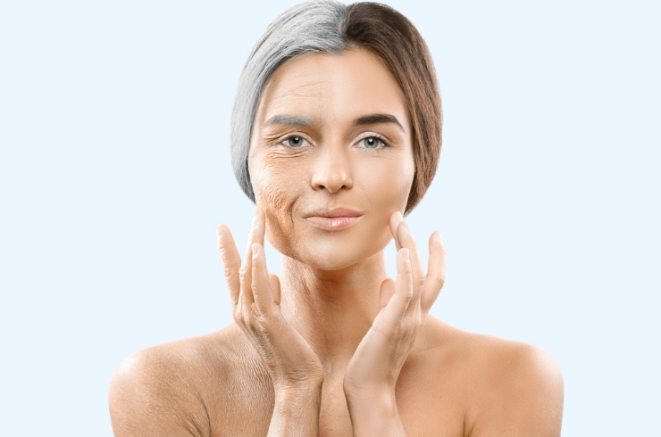 Premature Ageing image