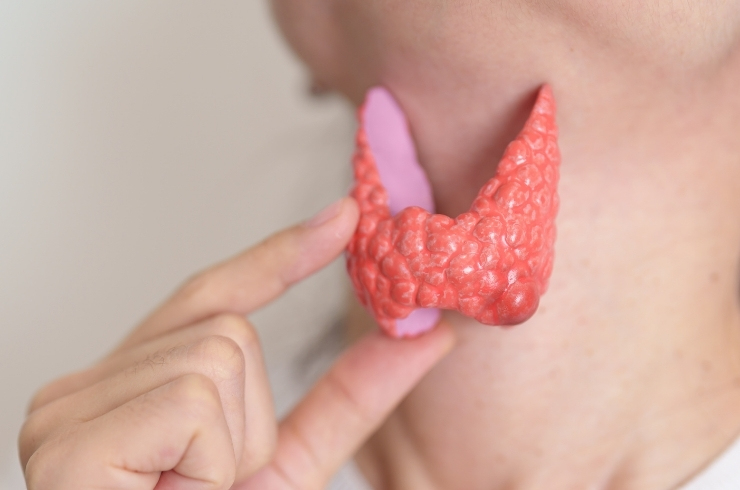 thyroid image