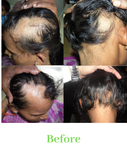 Before (2)