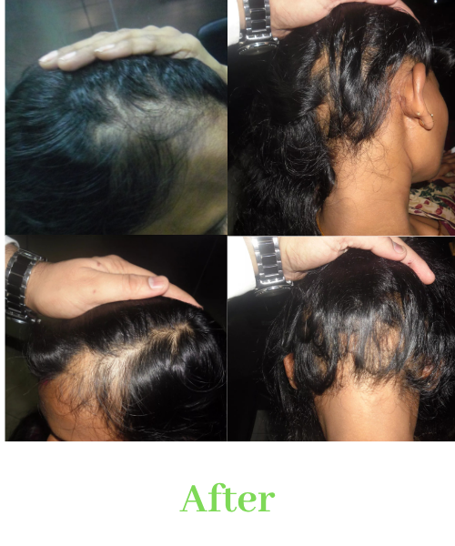 Before (3)