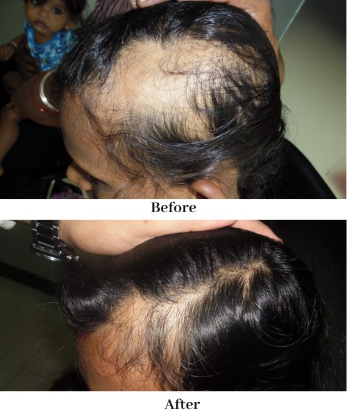 virashomeopathy